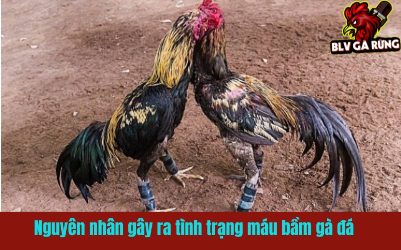 Máu bầm gà đá - dấu hiệu tổn thương mạch máu ngầm